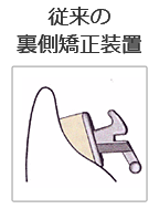 従来の装置