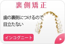 歯の裏側に付ける矯正