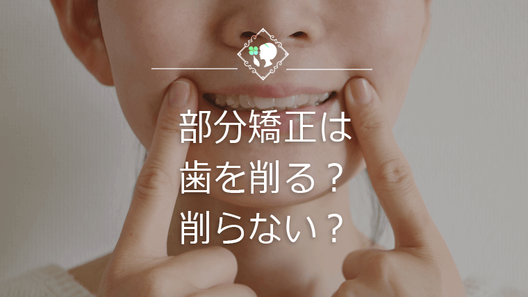 部分矯正は歯を削る？削らない？