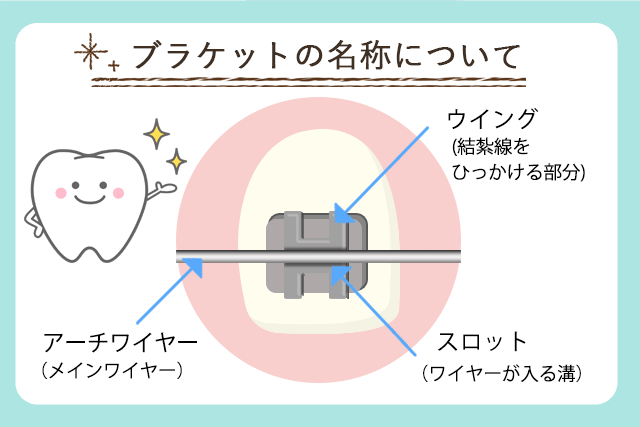 ブラケットの種類について