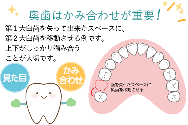 奥歯は噛み合わせが重要