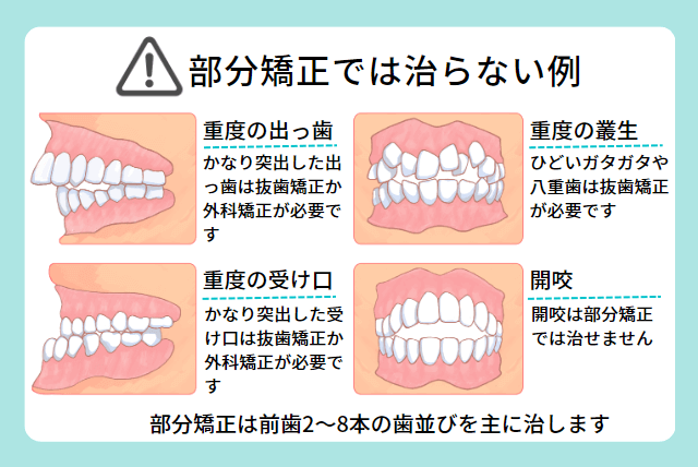 部分矯正では治らない例