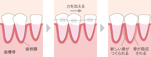 歯が動くしくみ