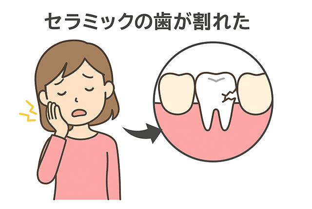 セラミックが割れた