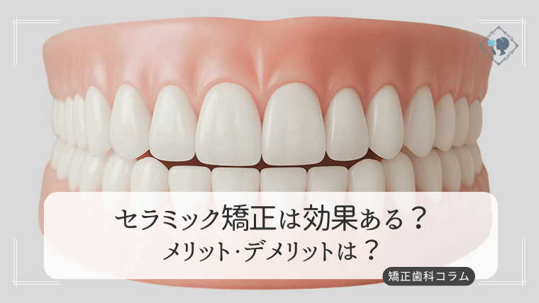 セラミック矯正は効果ある？メリット・デメリットは？
