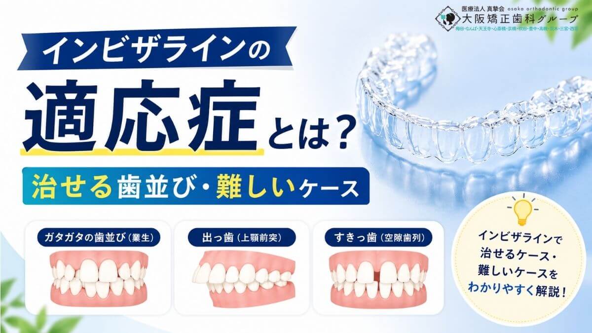 インビザラインの適応症とは？治せる歯並び・難しいケースの基礎知識