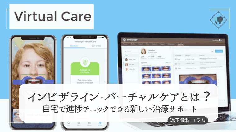 インビザライン・バーチャルケアとは？自宅で進捗チェックできる新しい治療サポート