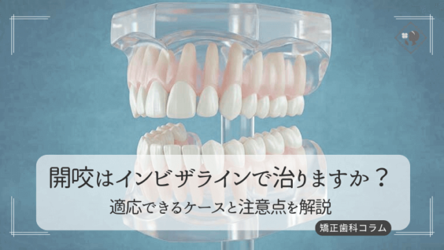 開咬はインビザラインで治りますか？適応できるケースと注意点を解説