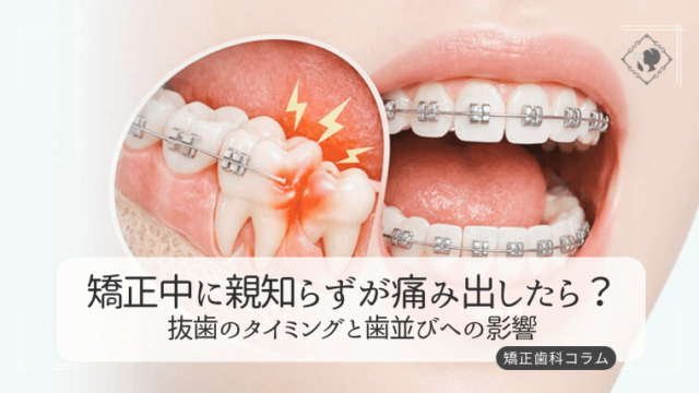 矯正中に親知らずが痛み出したら？抜歯のタイミングと歯並びへの影響