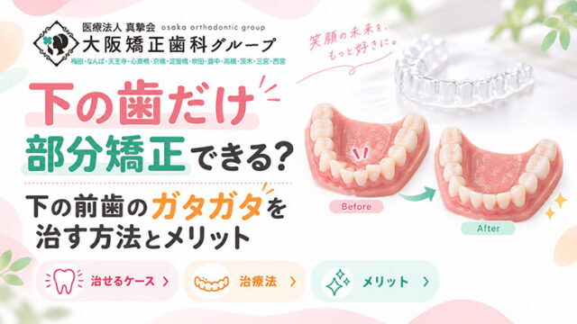 下の歯だけ部分矯正できる？下の前歯のガタガタを治す方法とメリット