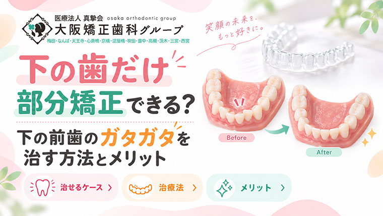 下の歯だけ部分矯正できる？下の前歯のガタガタを治す方法とメリット