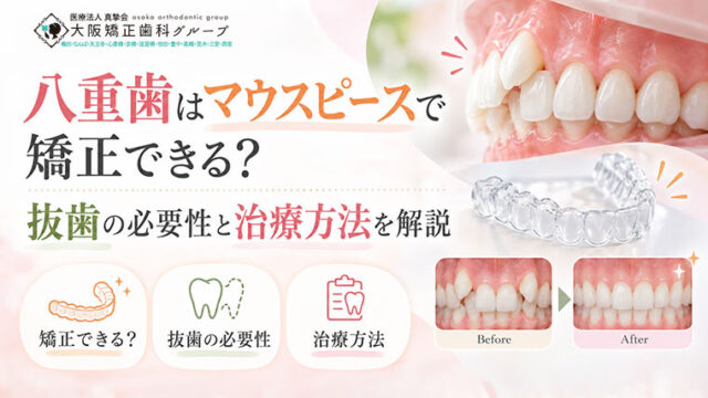 八重歯はマウスピースで矯正できる？抜歯の必要性と治療方法を解説