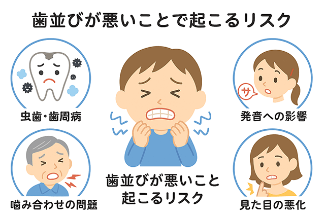 歯並びが悪いことで起こる6つのリスク