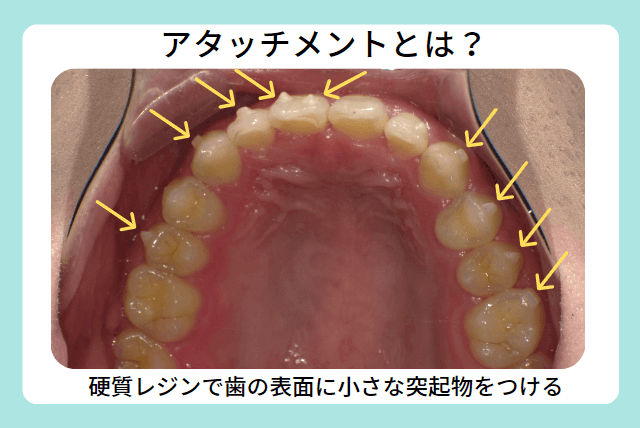 アタッチメントとは