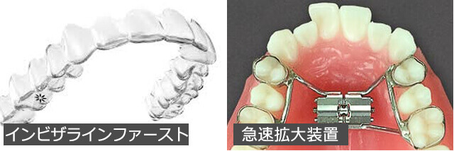 インビザラインファーストと急速拡大装置