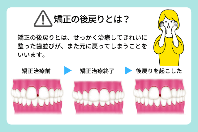 矯正の後戻りとは？