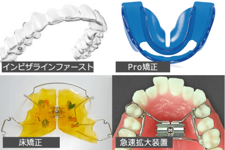 子どもの1期治療に使用する装置