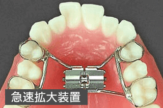 急速拡大装置