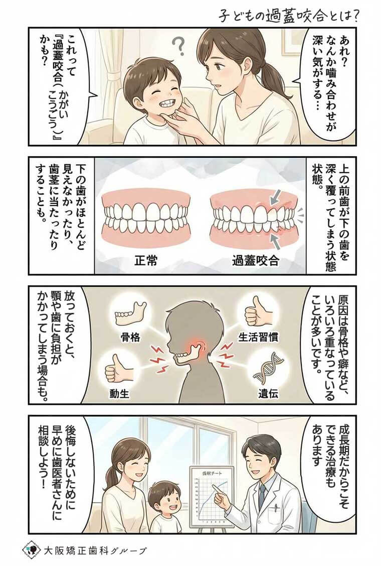 子どもの過蓋咬合とは？