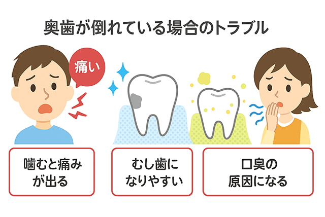 奥歯が倒れている場合のトラブル