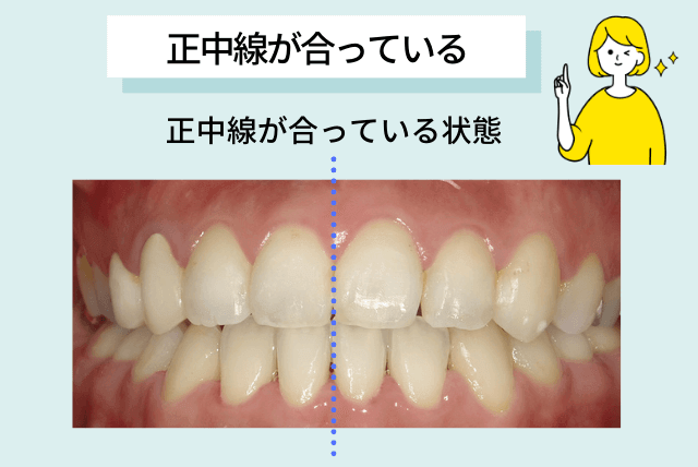 正中線