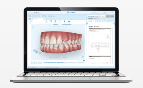 インビザライン　クリンチェック