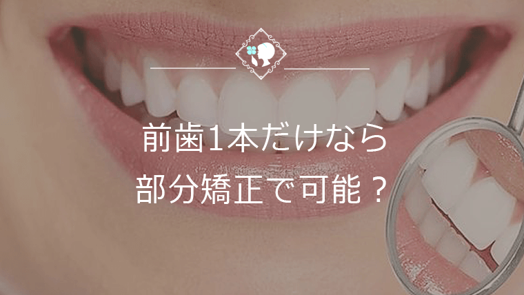 前歯1本だけなら部分矯正で可能？