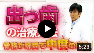 【動画】出っ歯の治療方法　骨格が原因で中度の場合