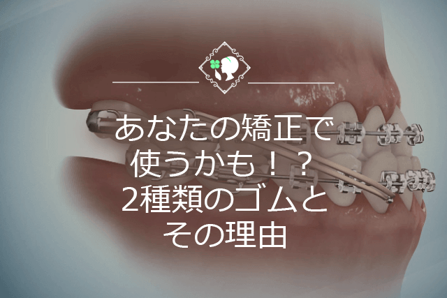 あなたの矯正で使うかも！？2種類のゴムとその理由