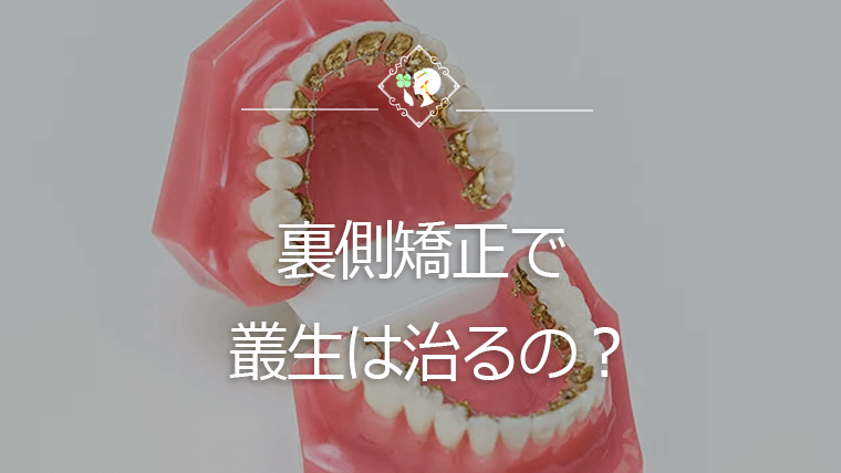 裏側矯正で叢生は治るの？