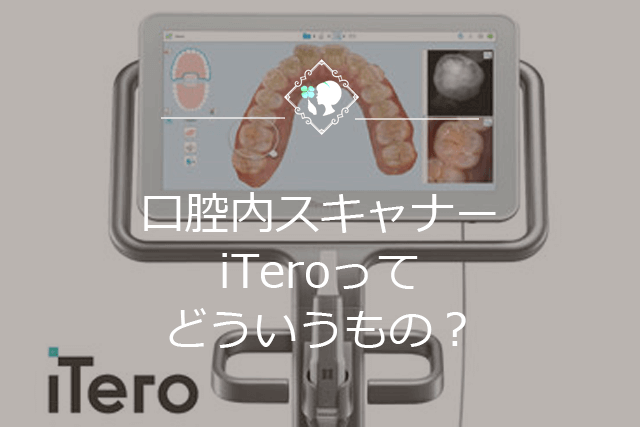 口腔内スキャナーiTeroってどういうもの？