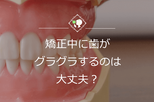 矯正中に歯がグラグラするのは大丈夫？