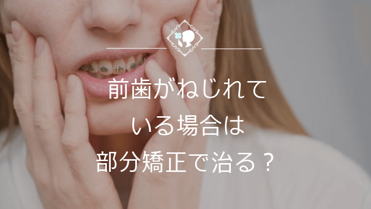 前歯がねじれている場合は部分矯正で治る？