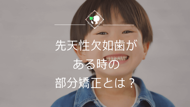 先天性欠如歯がある時の部分矯正とは？