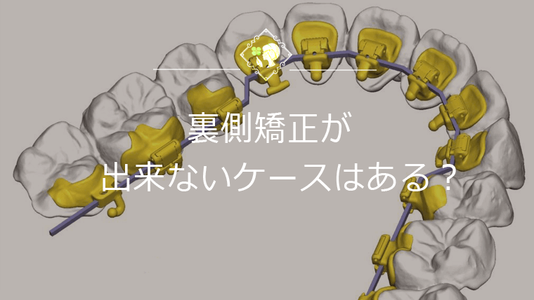 裏側矯正が出来ないケースはある？