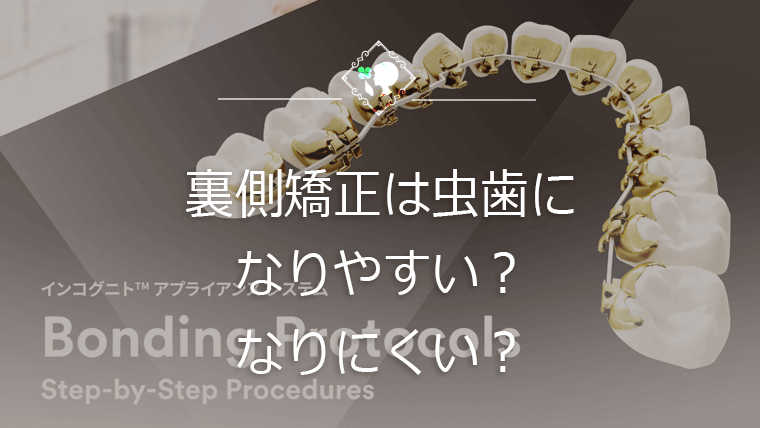 裏側矯正は虫歯になりやすい？なりにくい？