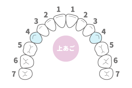 上あごの歯列