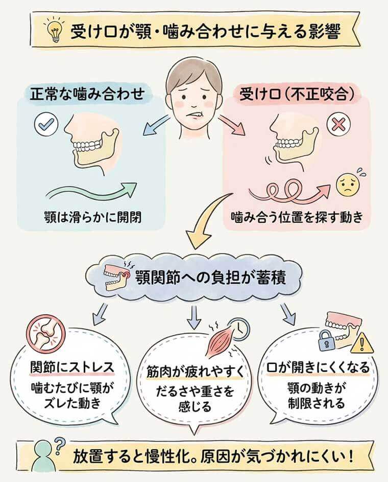 【図解】受け口は顎や噛み合わせにどのような影響を与えますか？