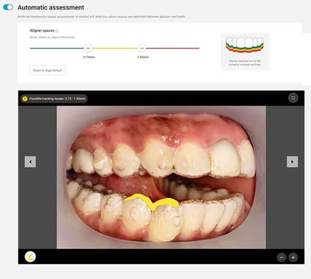 バーチャルケア