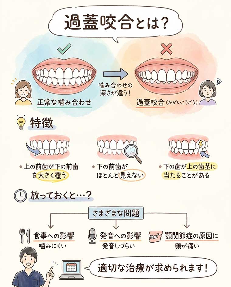 過蓋咬合とは？どのような状態なのかの図解