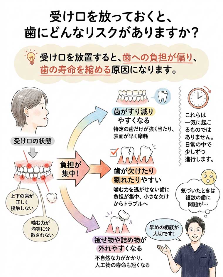 受け口を放っておくと、歯にどんなリスクがありますか？の図解