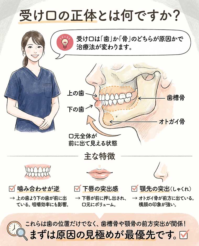 受け口・しゃくれの正体とは何ですか？の図解