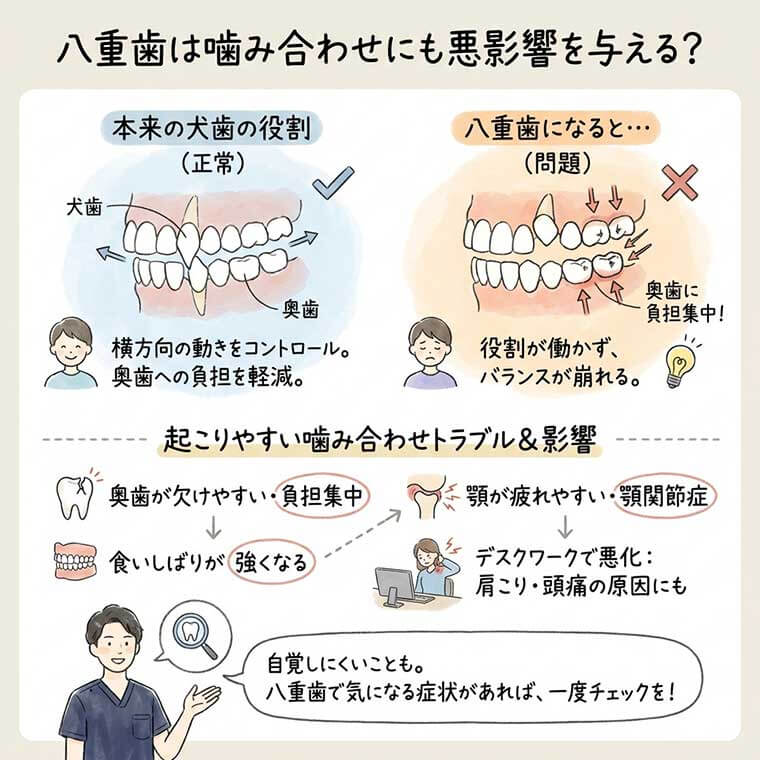 八重歯は噛み合わせにも悪影響を与える？の図解