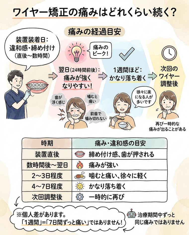 ワイヤー矯正の痛みはどれくらい続く？の図解