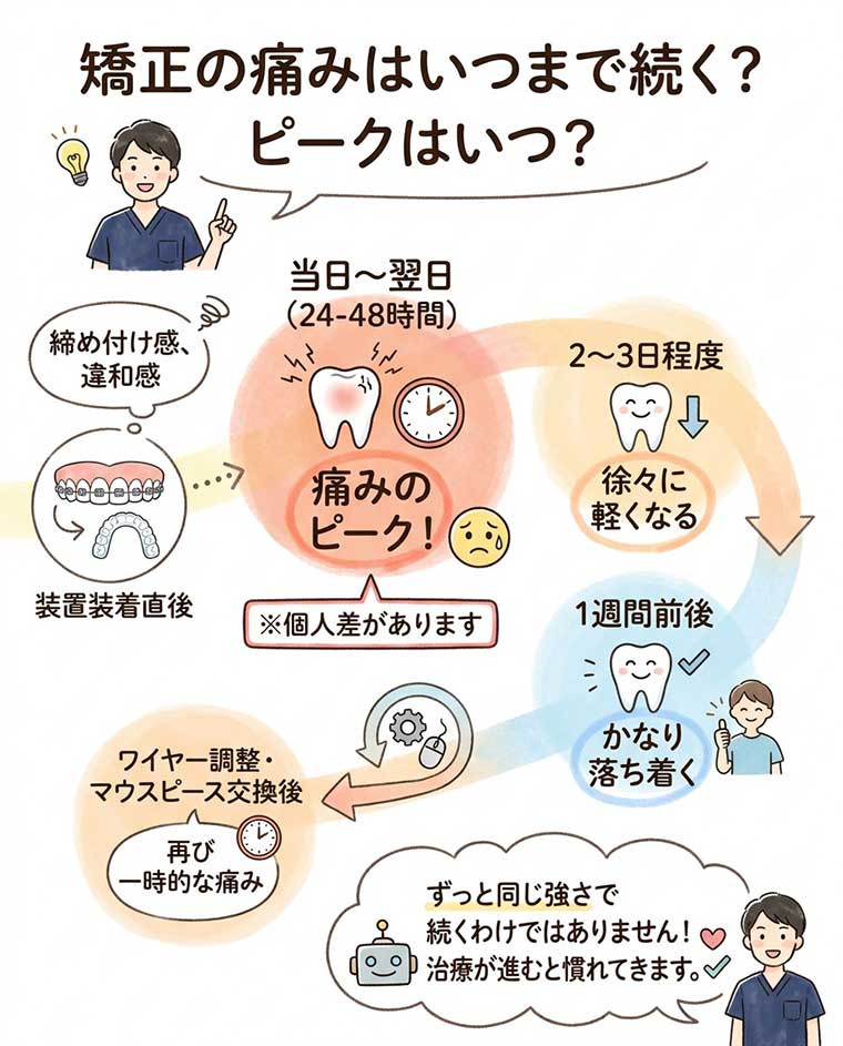 矯正の痛みはいつまで続く？ピークはいつ？の図解