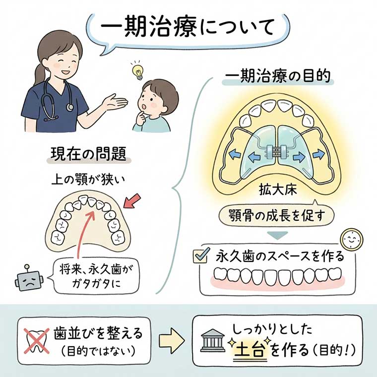 一期治療についての図解