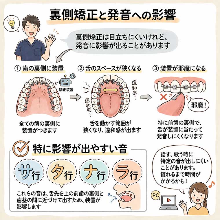裏側矯正では口や舌が動かしにくくなって発音に影響が出る？の図解