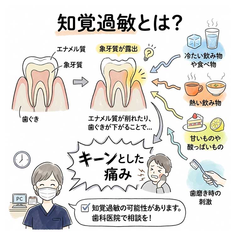 知覚過敏とは？の図解