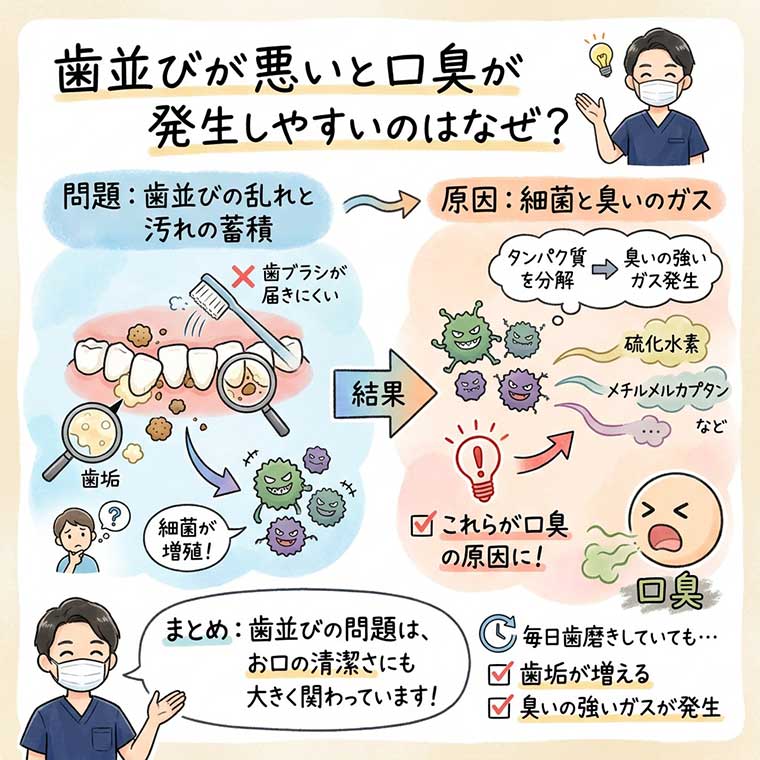 歯並びが悪いと口臭が発生しやすいのはなぜ？の図解