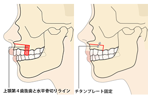 ゠ZbgobN